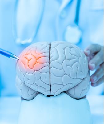 Emotional traumatic brain injuries.